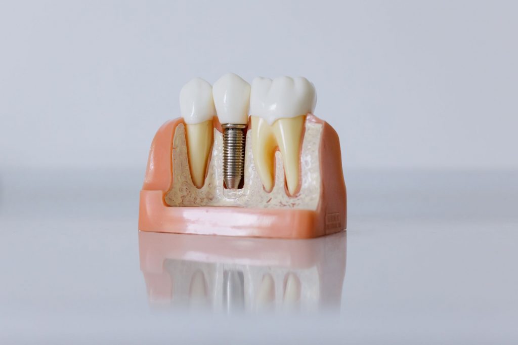 KMU in Thüringen nutzen Fördermittel für biokompatible Implantate.